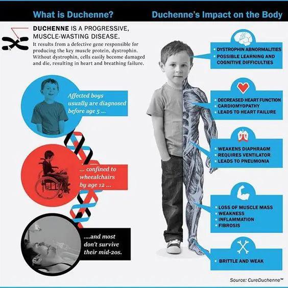 Illustration of Duchenne being a progressive, muscle-wasting disease with a boy about the same age as Hayes.